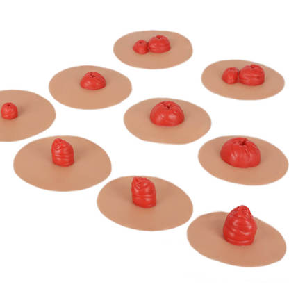 Sticky Ostomy Simulators Set