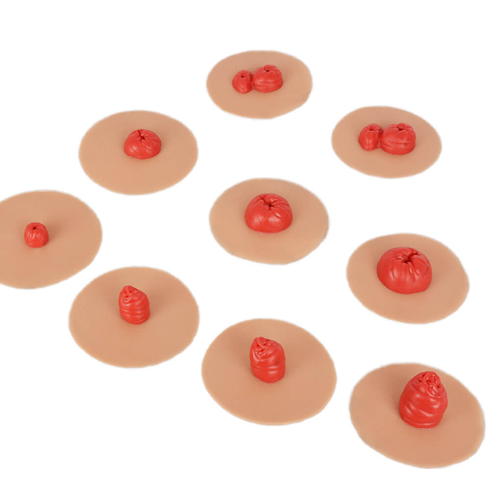 Sticky Ostomy Stoma Care Training Models Set