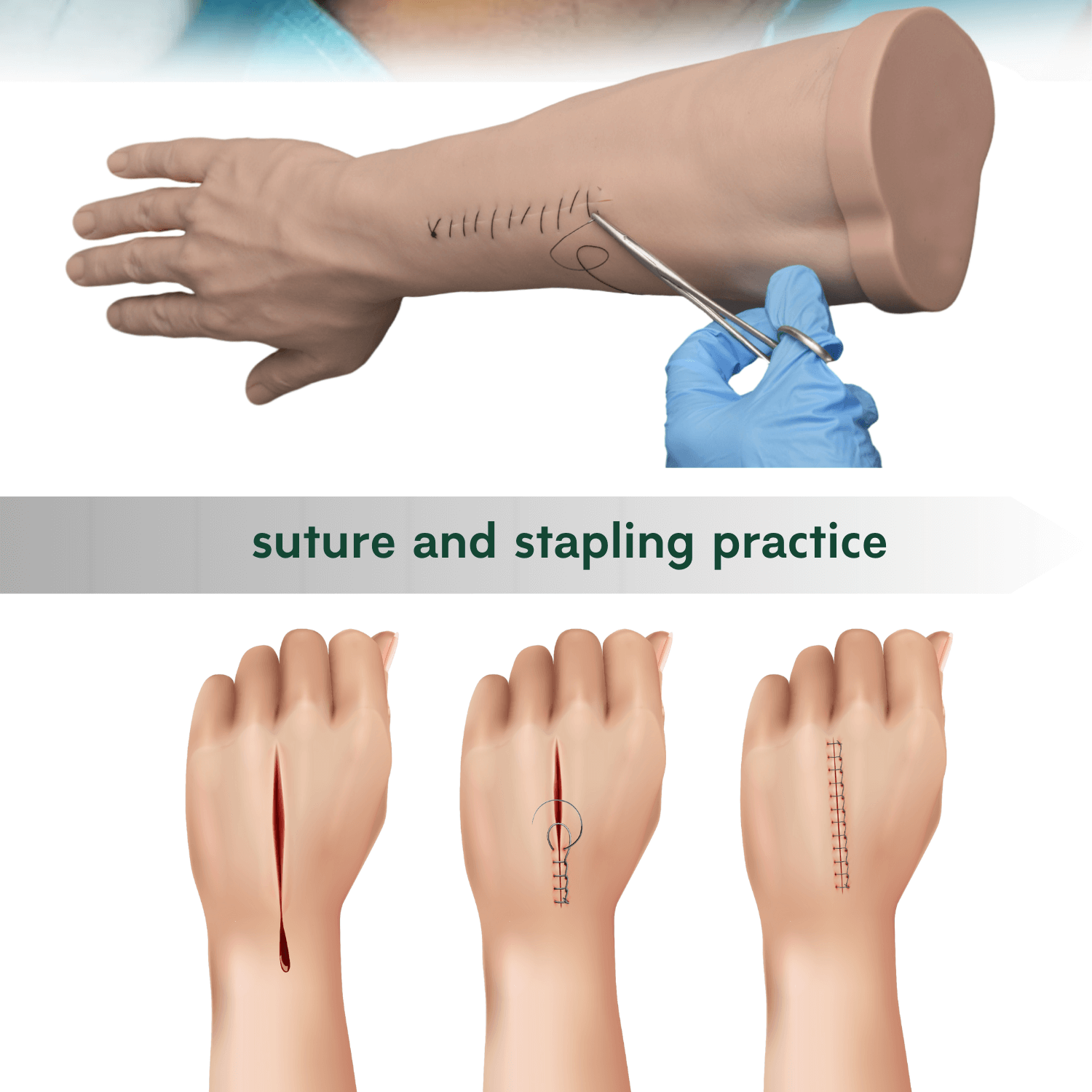Ultrassist Suturing and Stapling Arm