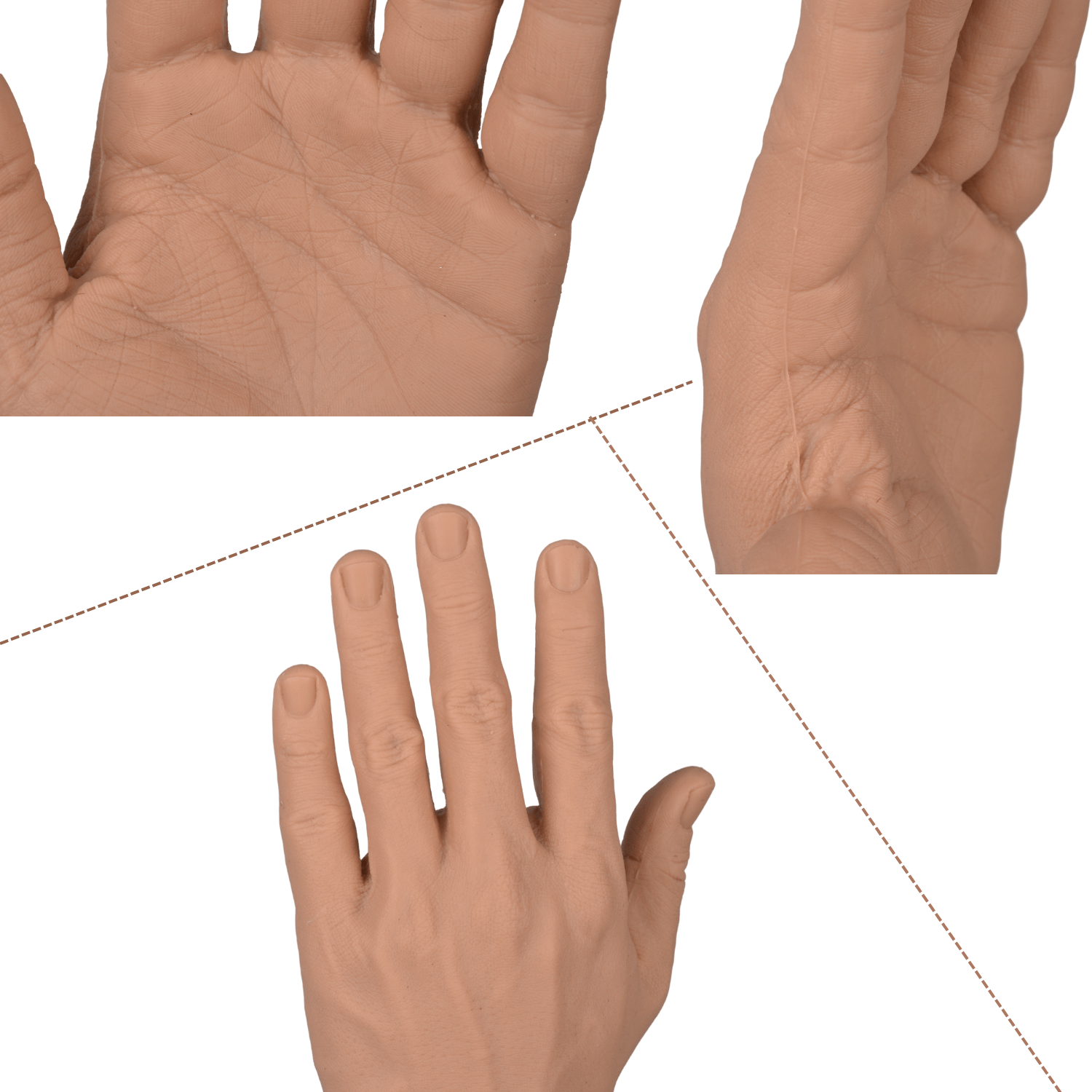 Realistic Arm Surgery Simulator