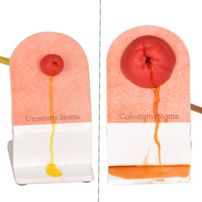 Tabletop Ostomy Care Training Kit with Display Stand