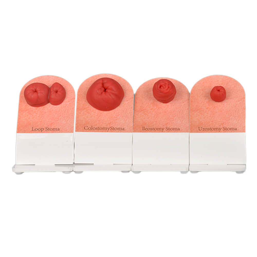 Tabletop Ostomy Care Training Kit with Display Stand