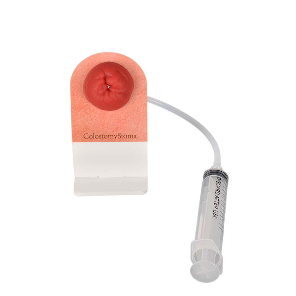 Wearable Ostomy Stoma Simulator Set, Multi-Skin Tone, Silicon Model