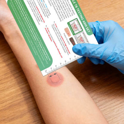 Palpable TB Testing Arm Set (Mantoux Method)
