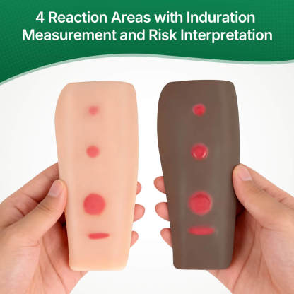 Palpable TB Testing Arm Set (Mantoux Method)