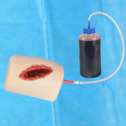Thigh Laceration Wound Packing Trainer Kit - Ultrassist in Action