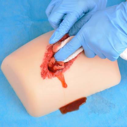 Hands-On Learning with Ultrassist Wound Packing Trainer