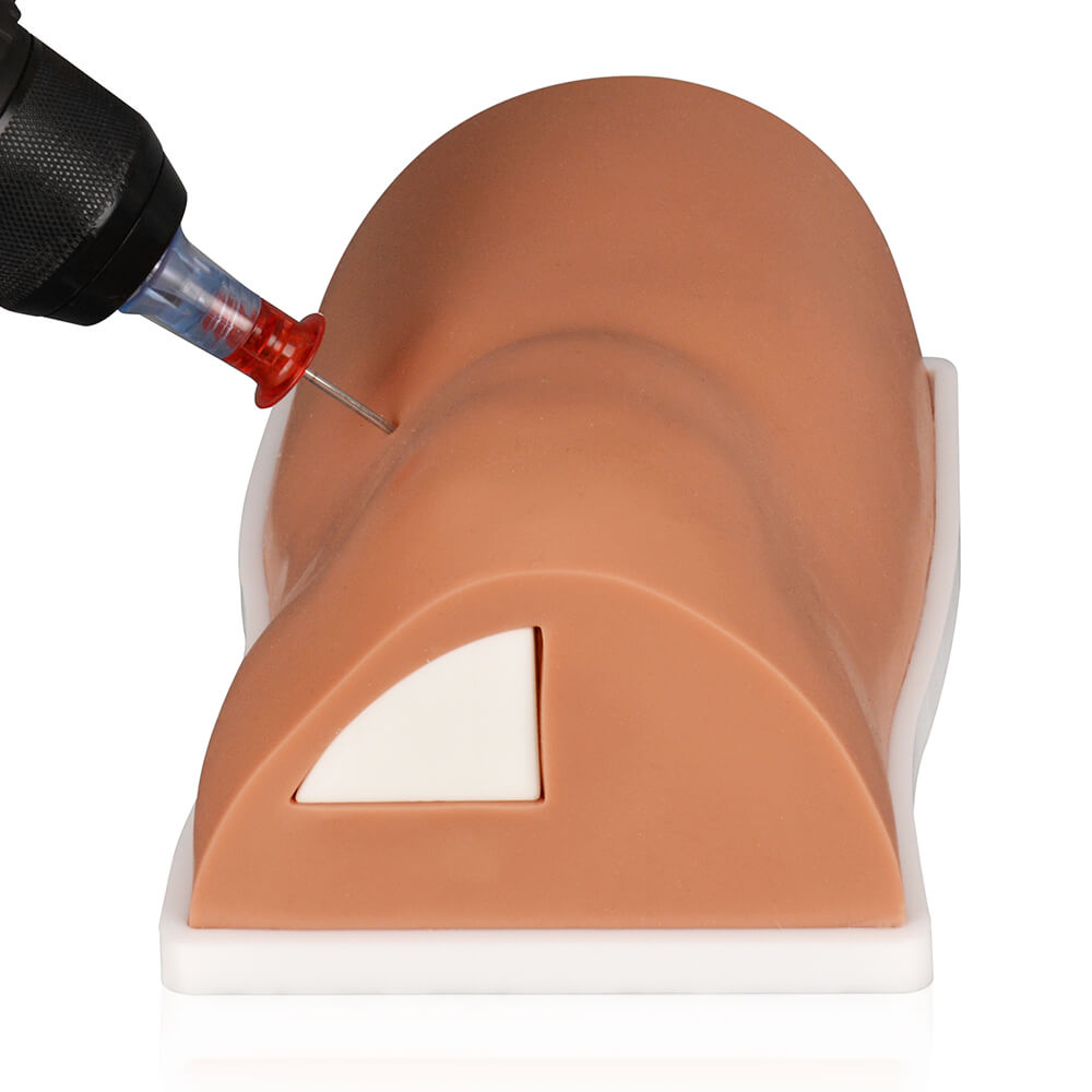 Tibia IO Task Trainer with Removable Bone