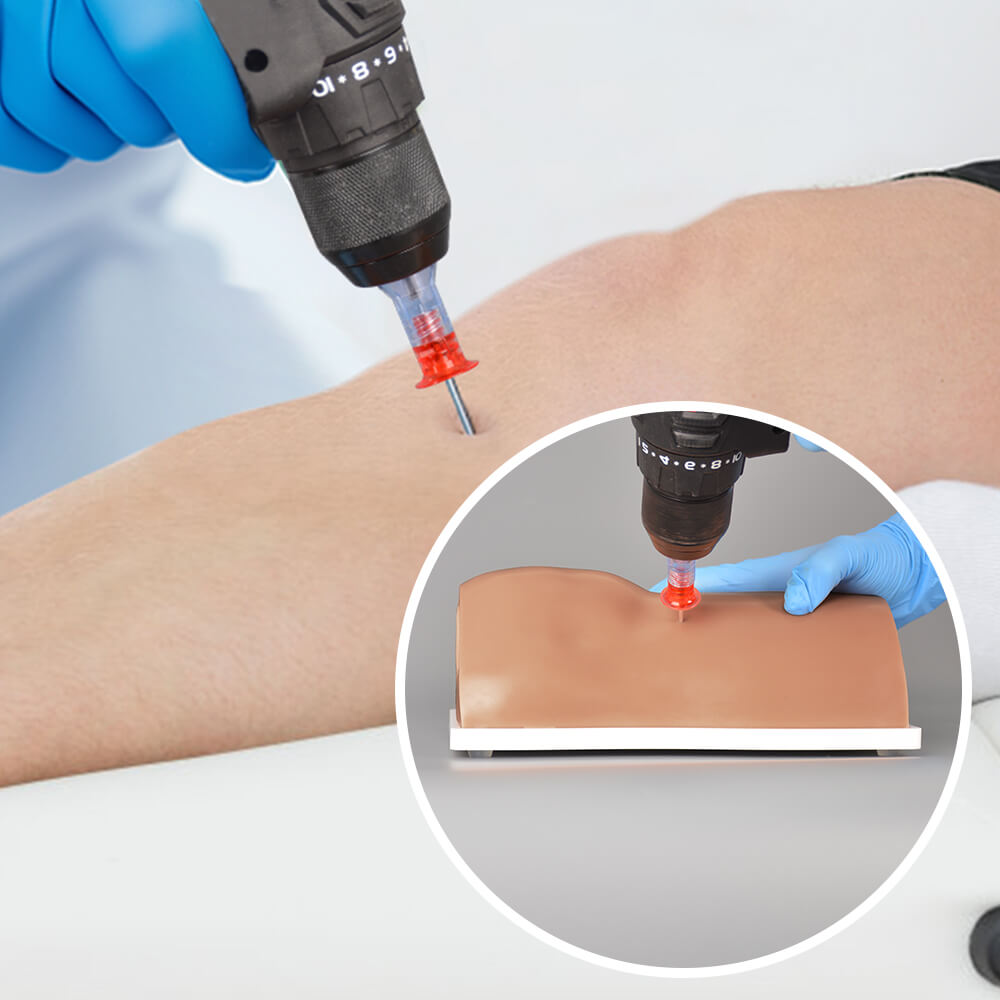 Tibia IO Task Trainer with Removable Bone