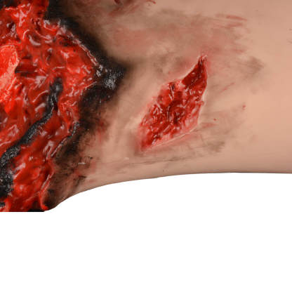 Amputation Thigh Wound Simulator with Realistic Open Wound