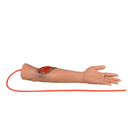 Trauma Arm with Laceration and Fracture Wound 