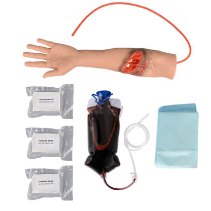 Trauma Arm with Laceration and Fracture Wound 