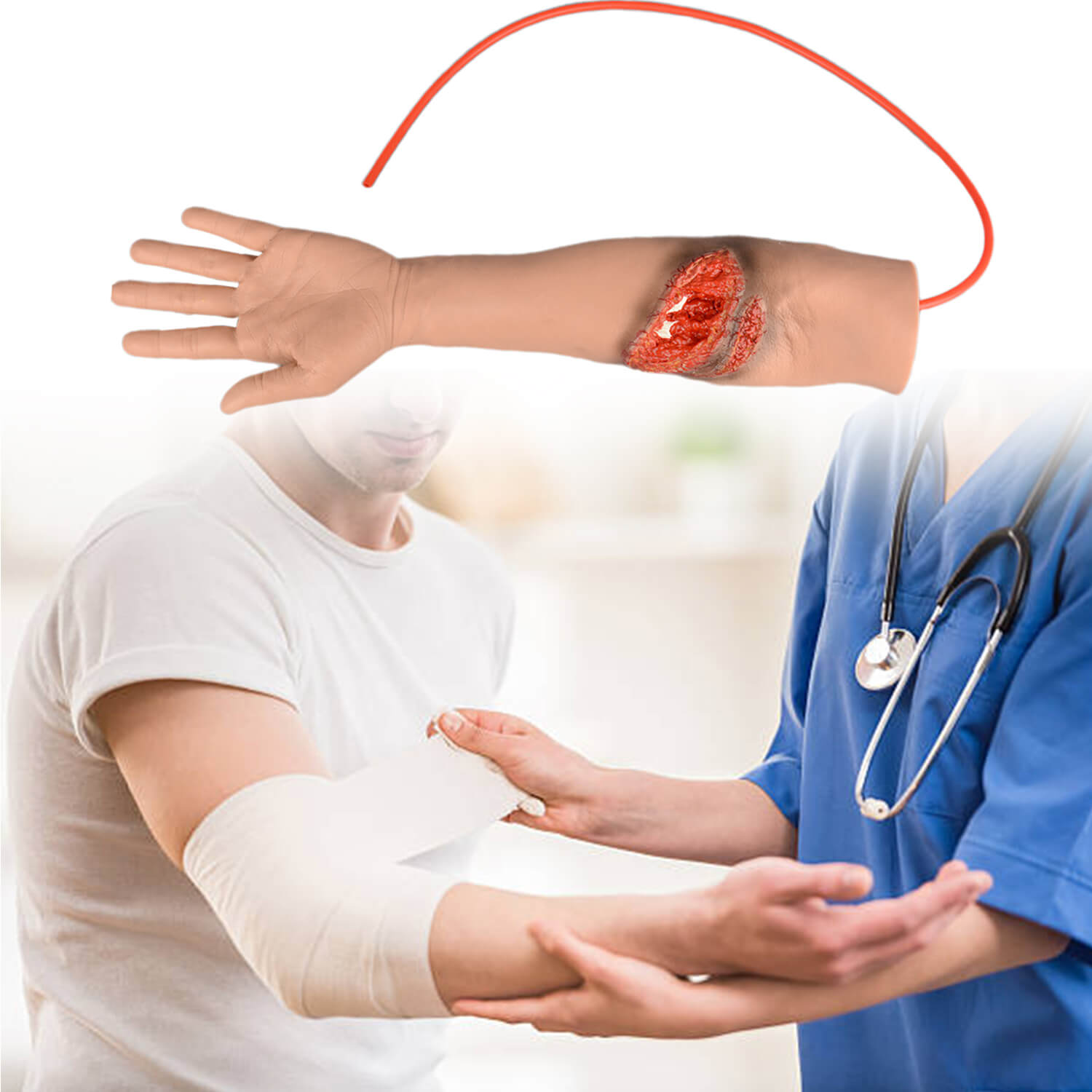 Trauma Arm with Laceration and Fracture Wound 