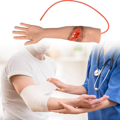 Trauma Arm with Laceration and Fracture Wound 