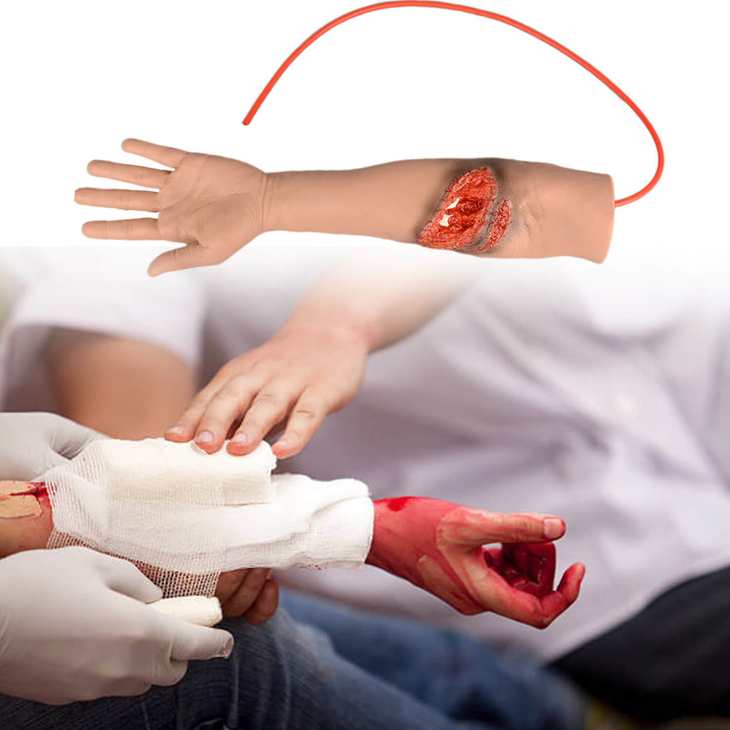 Trauma Arm with Laceration and Fracture Wound 