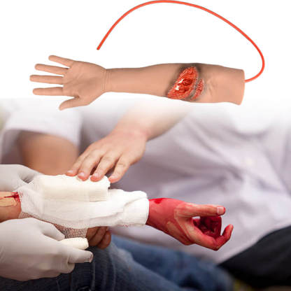 Trauma Arm with Laceration and Fracture Wound 