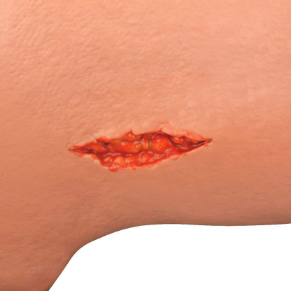 Amputated Trauma Arm Trainer