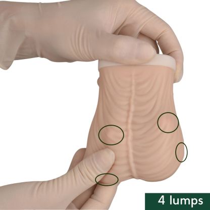 Testicular Self Examination Model with 4 Lumps