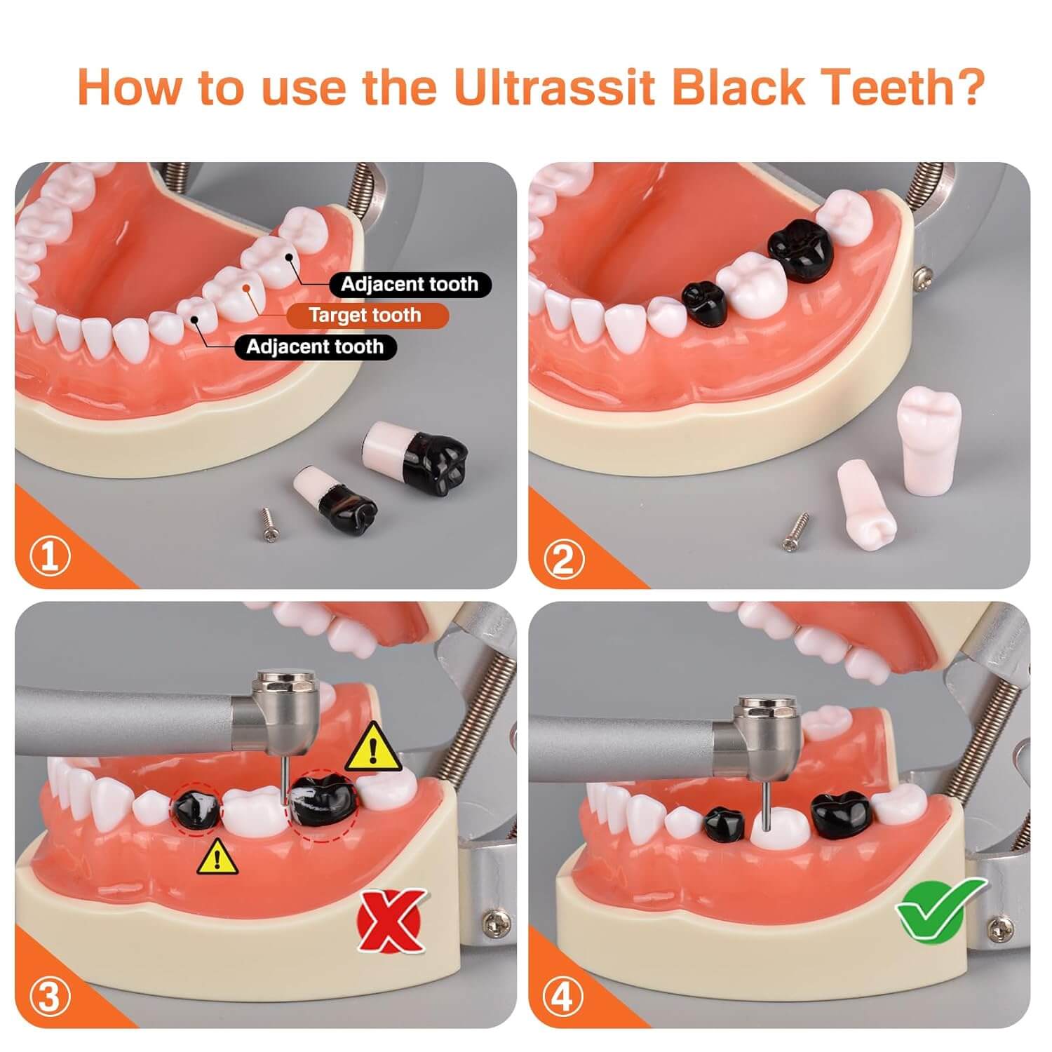 Dental Typodont with 32 Removable Teeth & 24 Black Replacement Teeth