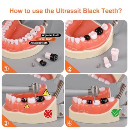 Dental Typodont with 32 Removable Teeth & 24 Black Replacement Teeth