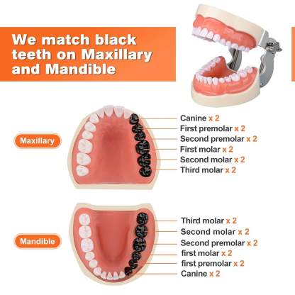 Dental Typodont with 32 Removable Teeth & 24 Black Replacement Teeth