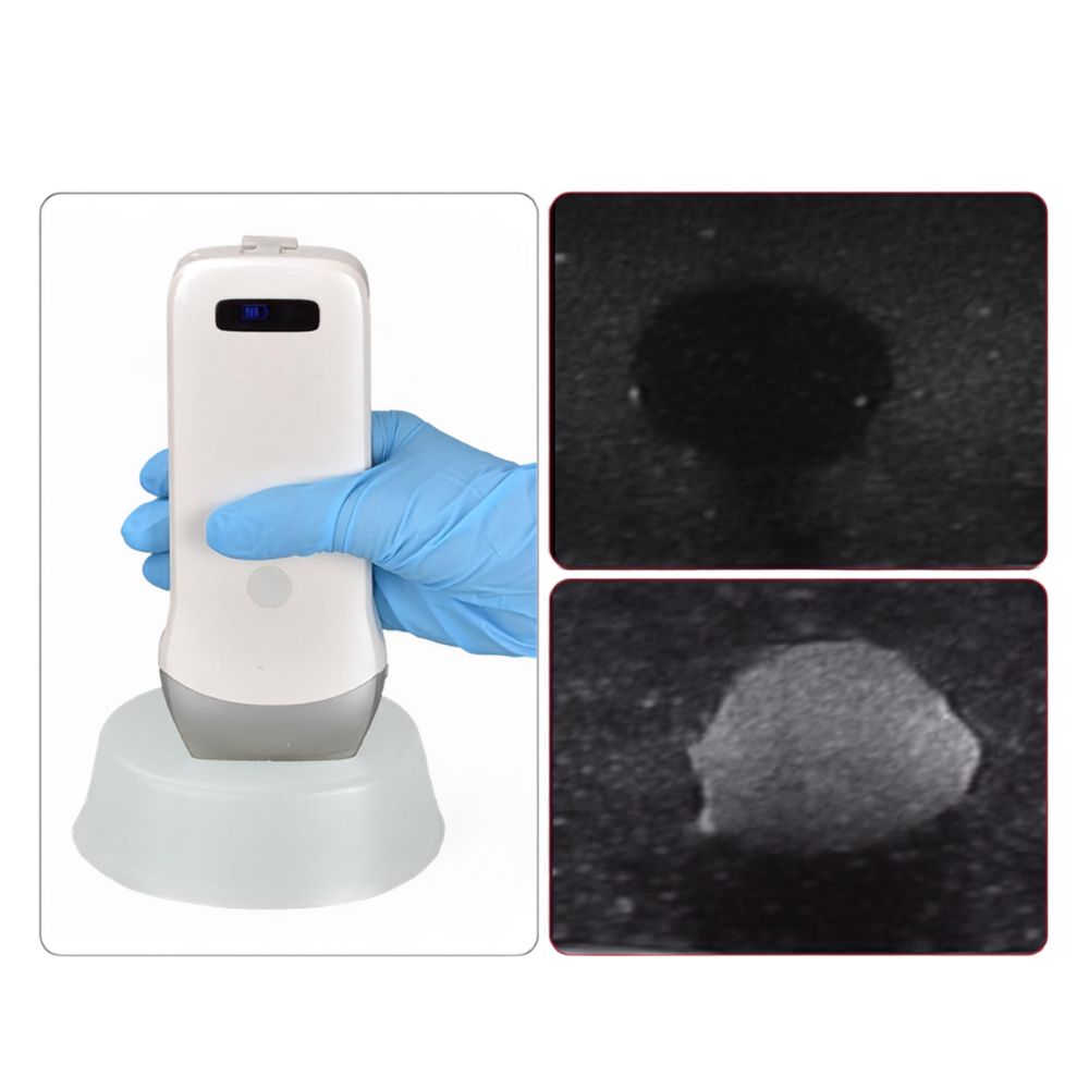 Transparent Ultrasound Biopsy Phantom with Dual-Echoic Masses