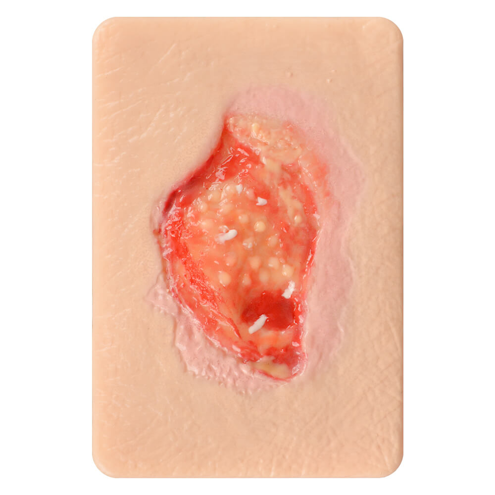Granulation Tissue Wound Simulation Models Set