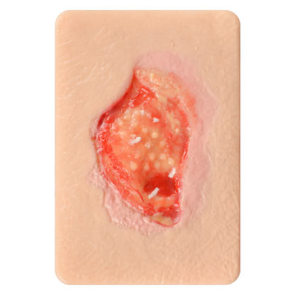 Granulation Tissue Wound Simulation Models Set