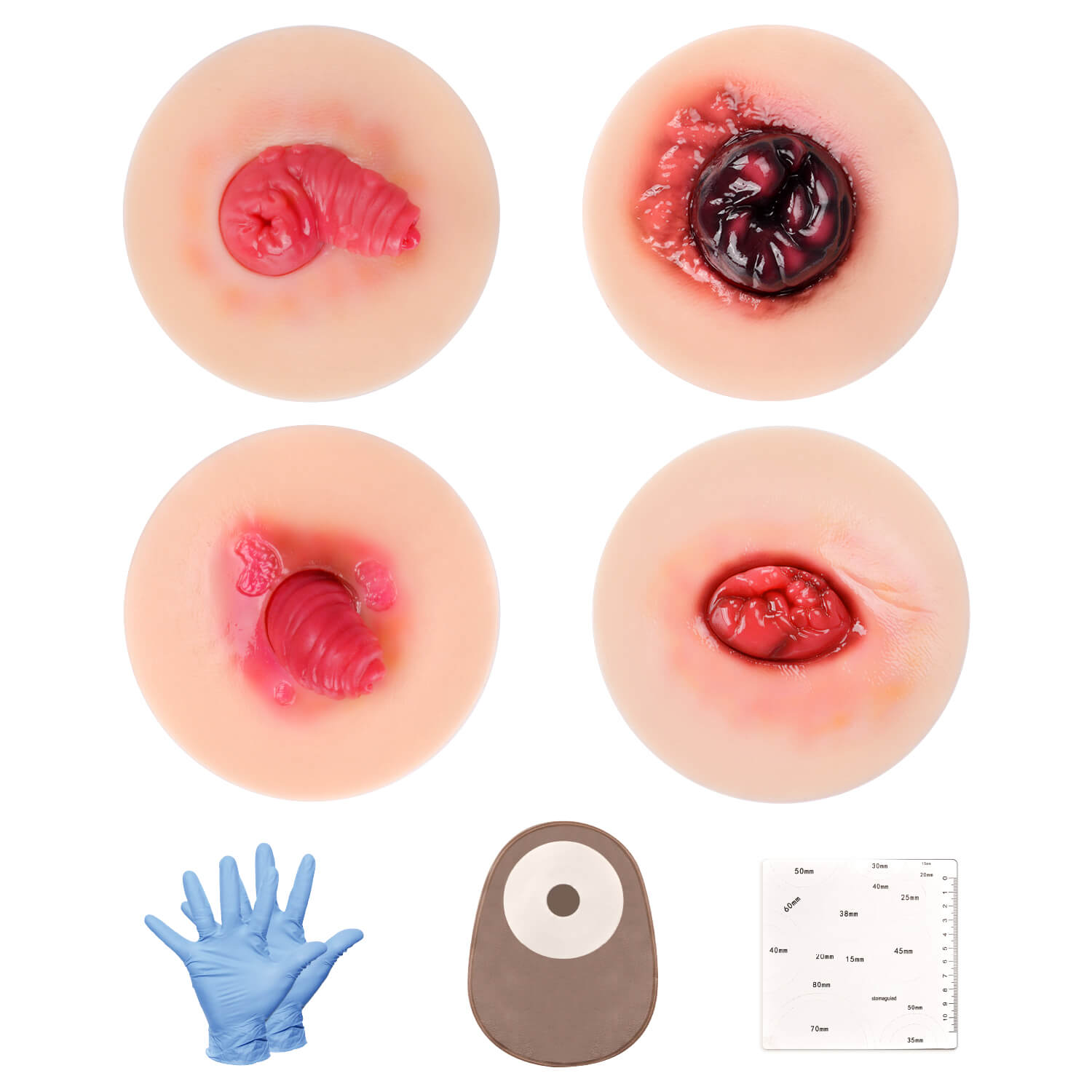 Stick-On Unhealthy Stoma Simulation Models Set for Ostomy Care Training