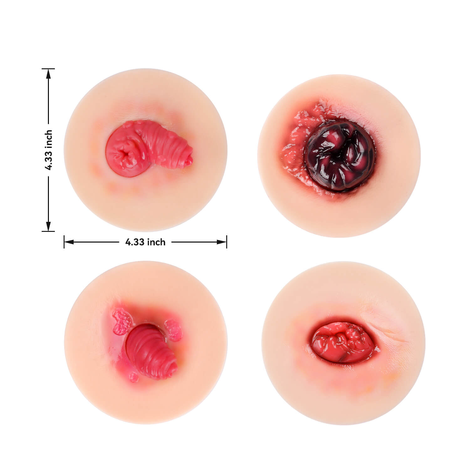 Abnormal Stoma Simulation Model Size