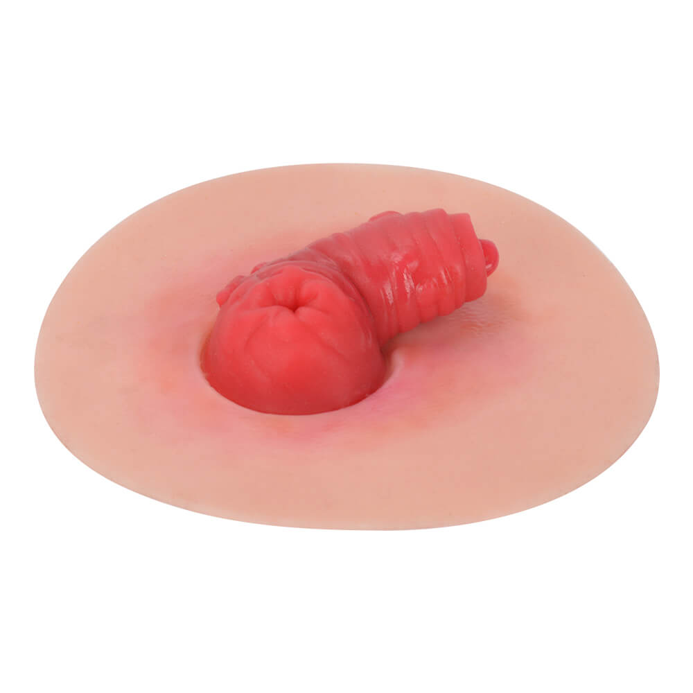
Abnormal Stoma Simulation Model