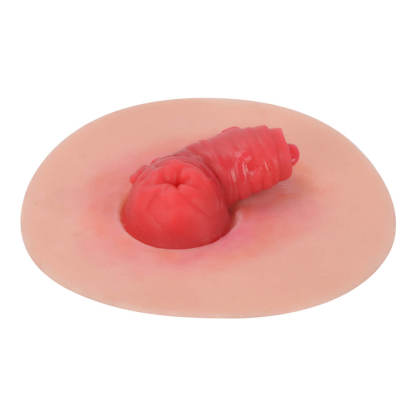 
Abnormal Stoma Simulation Model