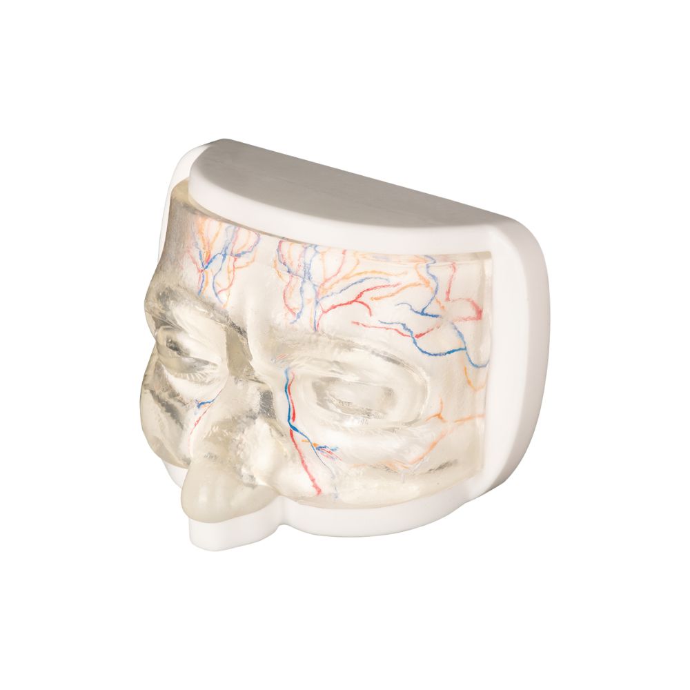 Upper Facial Cosmetic Injection Training Model with Simulated Blood Vessels