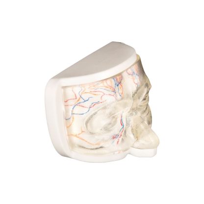 Upper Facial Cosmetic Injection Training Model with Simulated Blood Vessels