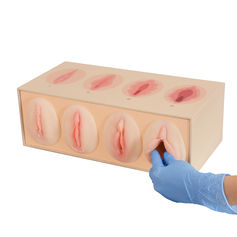 Vaginal Tightness Comparison Model for OB/GYN Training