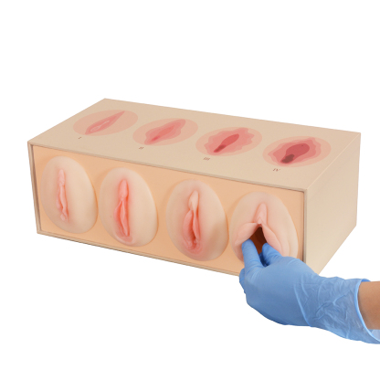 Vaginal Tightness Comparison Model for OB/GYN Training