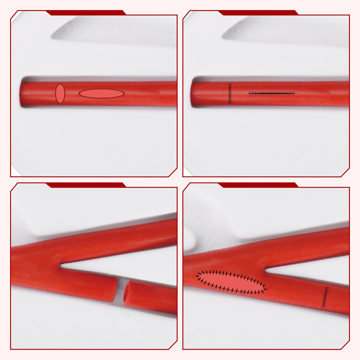 Ultrassist Vascular Anastomosis Training Kit for Suture Practice