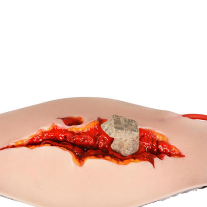 Wearable Abdominal Trauma Wound Trainer with Embedded Foreign Object
