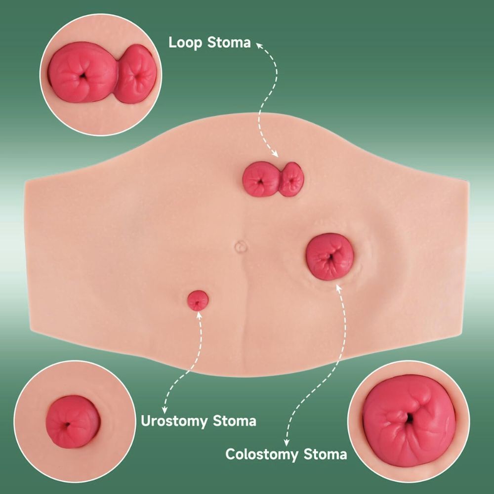Ultrassist Wearable Belly Ostomy Training Model with Simulated Excretion
