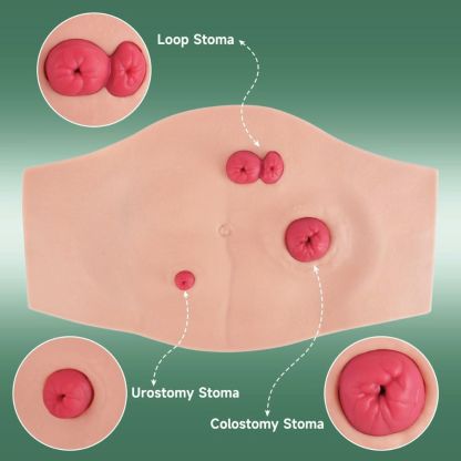 Ultrassist Wearable Belly Ostomy Training Model with Simulated Excretion