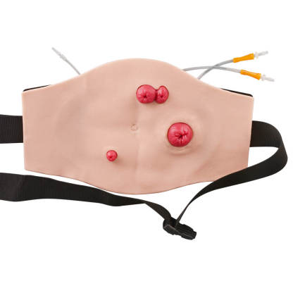 Ultrassist Wearable Belly Ostomy Training Model with Simulated Excretion