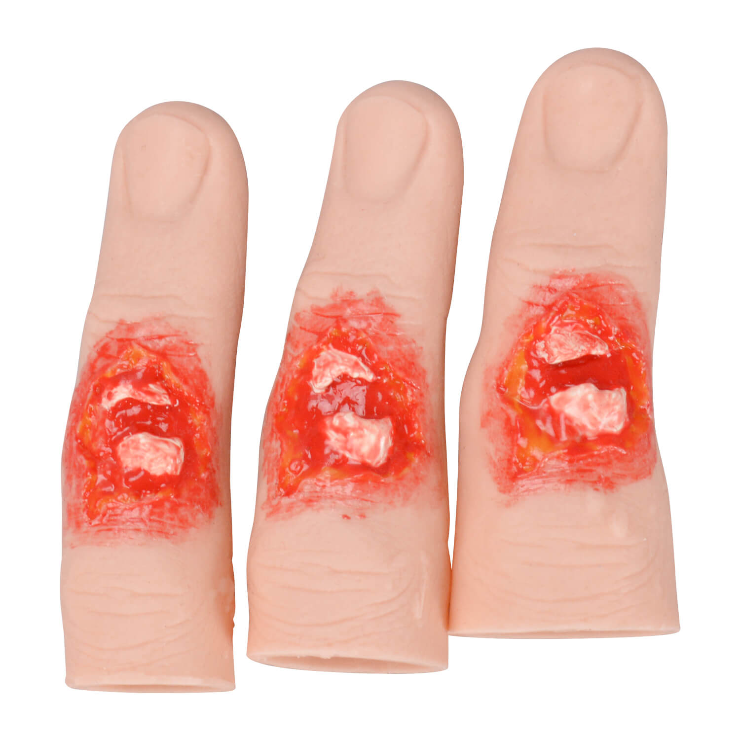 Wearable Finger Fracture Wound Trainer Set (3 Sleeve Sizes)