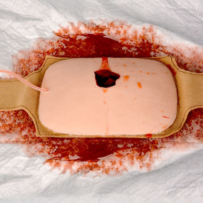 Wearable Haemostatic Wound Packing Trainer Kit