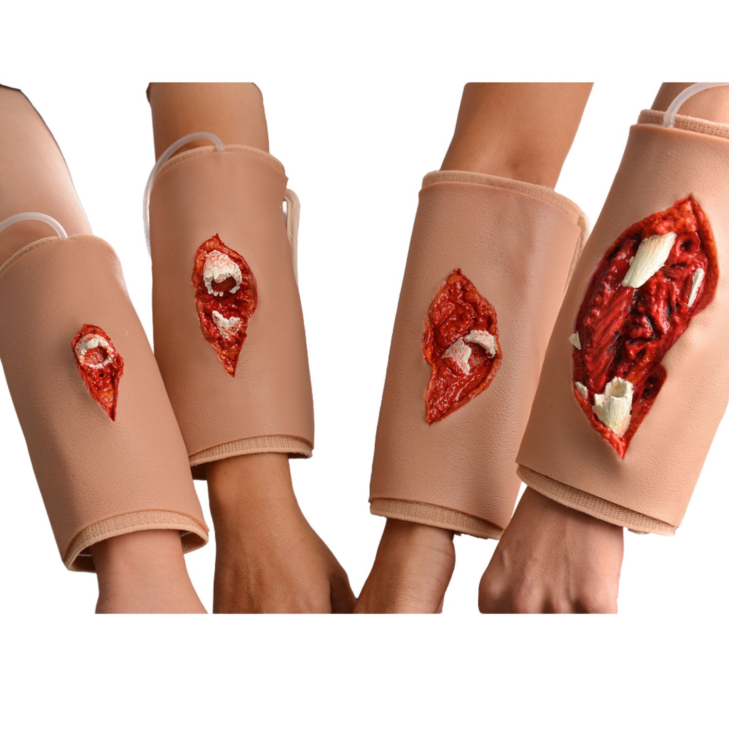 Wearable Open Fracture Wound Packing Trainer, Type Ⅱ, ⅢA, ⅢB, ⅢC