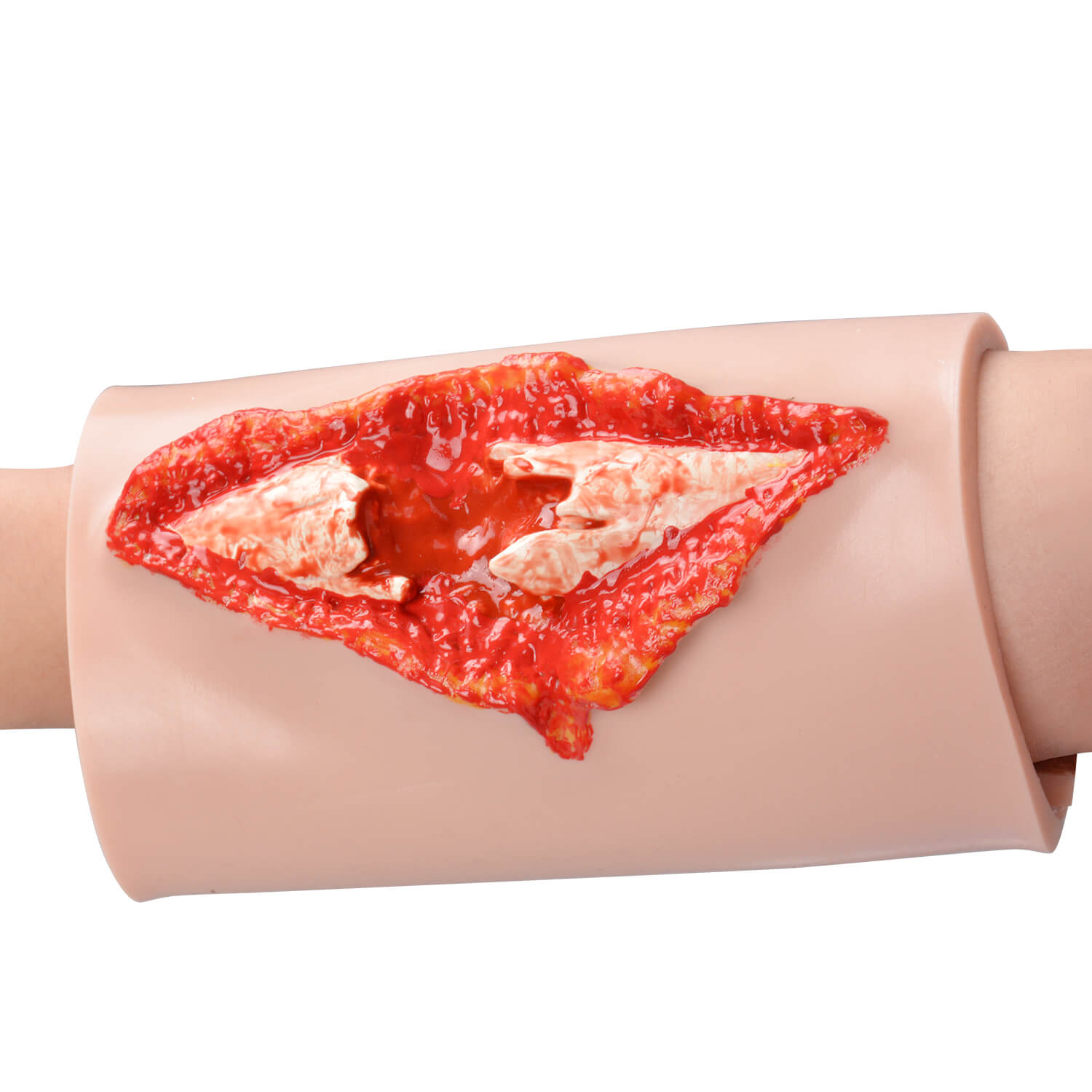 Wearable Open Fracture Wound Training Model