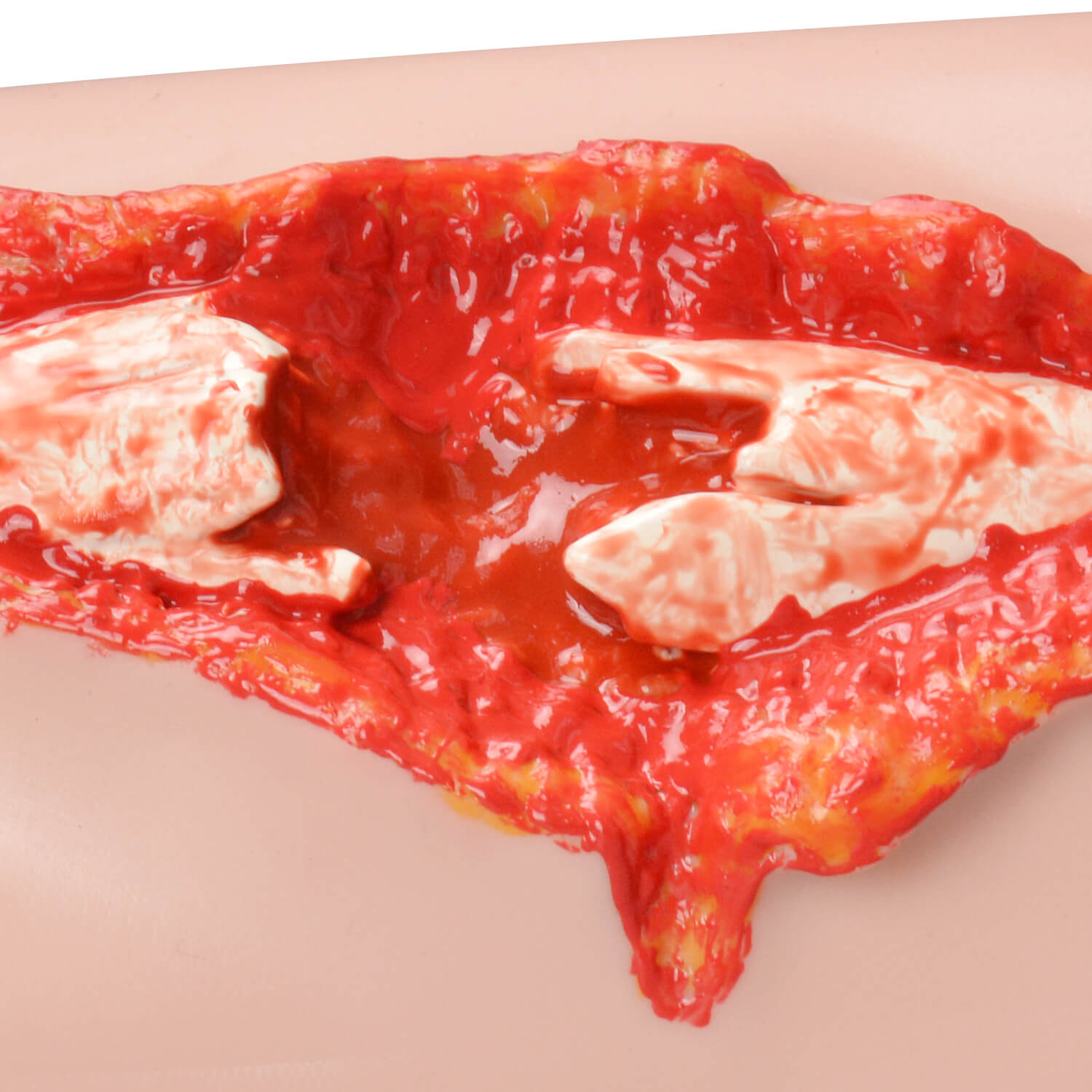 Realistic Open Fracture Wound Training Model