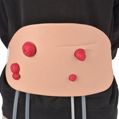 Wearable Ostomy Care Trainer Model 