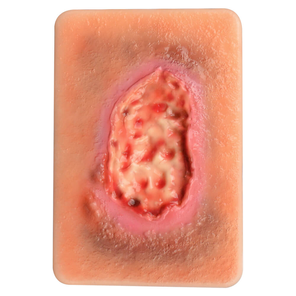 Pocket-Sized Necrotic Tissue Wound Simulation Model Set