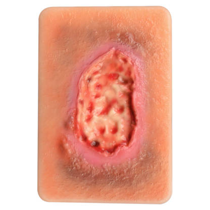 Pocket-Sized Necrotic Tissue Wound Simulation Model Set