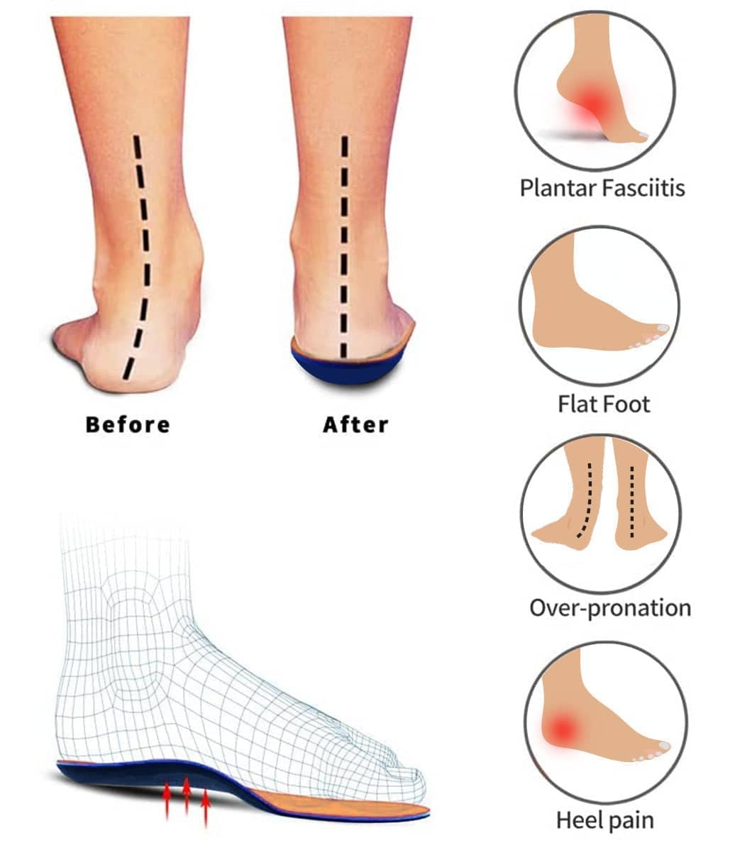 Women's Comfortable Orthopedic Shoes,Lightweight Anti-slip Shoes(🔥Free Shipping & Buy 2 Get Extra 10% Off🔥)-dressweeks